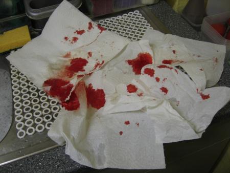 LA 2 EME EMORAGIE DE KIM .