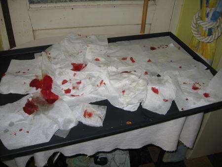 FR�LE LA CATASTROPHE .