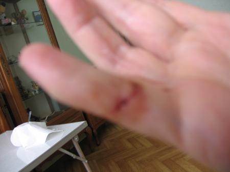 AIE AIE AIE  MAMY A ETE MORDUE .