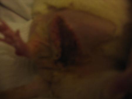 LA PLAIE DE  SUZY  .