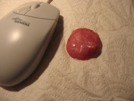 LA  TUMEUR  DE  RITA  .