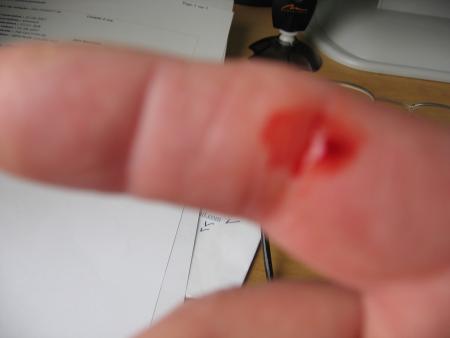 ENCORE UN TROU DANS LE DOIGT A PAPY LOL