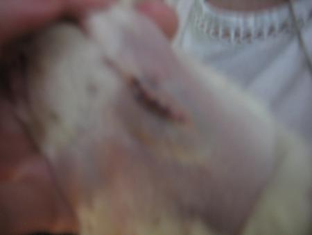 2 EME OPERATION DE SUZY  .